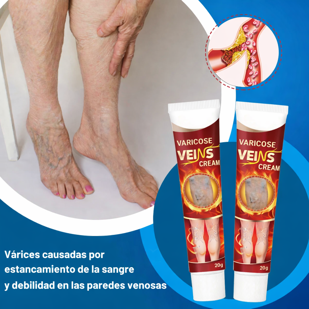 Crema para várices - Alivio inmediato, piernas más livianas y circulación mejorada.